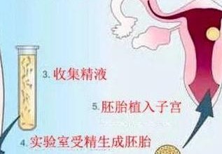 广州机构试管婴儿费用详解，全程费用一览及影响因素分析