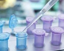 三代试管基因检测需要多长时间，成都西南三代试管基因检测时间
